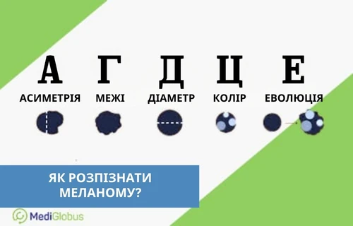 Як розпізнати рак шкіри? Інфографіка: Як розпізнати рак шкіри?