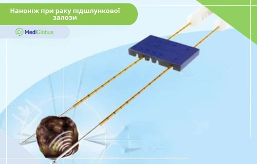 Медична схема процедури «Наноніж»: два електроди підключені до пристрою та введені в пухлину