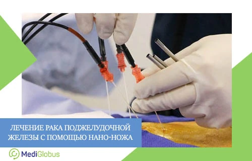 Нано-нож при лечении рака поджелудочной врач в стерильных перчатках проводит процедуру нано-нож