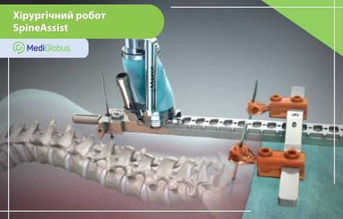 Хірургічний робот SpineAssist Візуалізація проведення операції на хребті за допомогою хірургічного робота SpineAssist