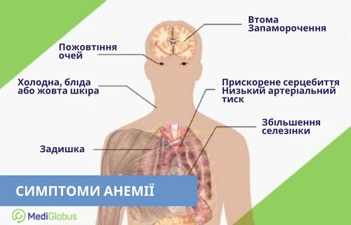 Апластична анемія — рідкісне захворювання крові, що викликає втому та порушення кровотворення Інфографіка «Симптоми анемії» із зображенням людського тіла та підписами можливих симптомів.