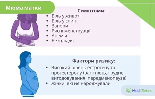 Міома матки: причини та ознаки Інфографіка: Причини та ознаки міоми матки