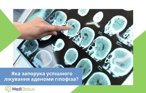 Мультидисциплінарний підхід - запорука успішного лікування аденоми гіпофіза рука вказує на серію знімків головного мозку, зроблених методом МРТ або КТ