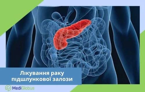 анатомічна 3D-схема черевної порожнини людини, на якій червоним кольором виділено підшлункову залозу