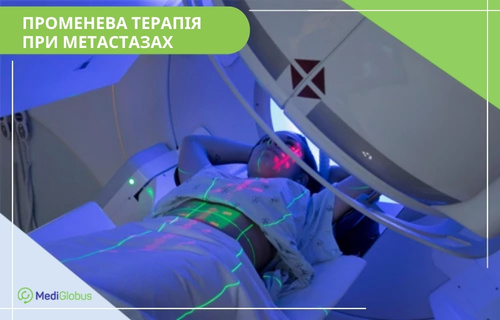 Променева терапія при метастазах Пацієнтка під час процедури променевої терапії: жінка лежить на медичному столі лінійного прискорювача, на її тіло та обличчя проектуються лазерні лінії розмітки для точного спрямування опромінення.