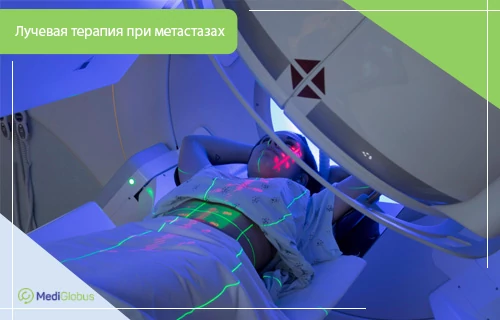 лучевая терпапия при метастазах