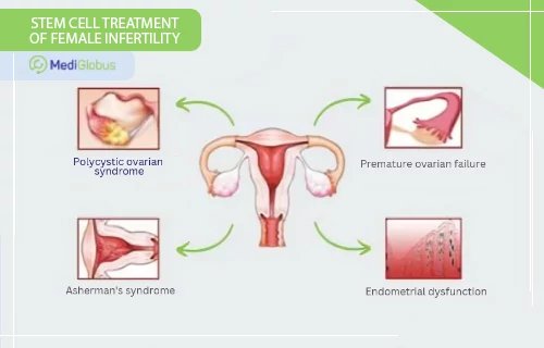 stem cells for female infertility