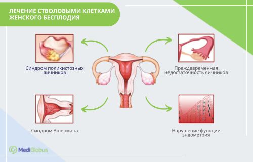 Снижение подвижности сперматозоидов у мужчин