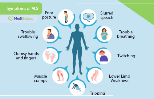 symptoms of ALS
