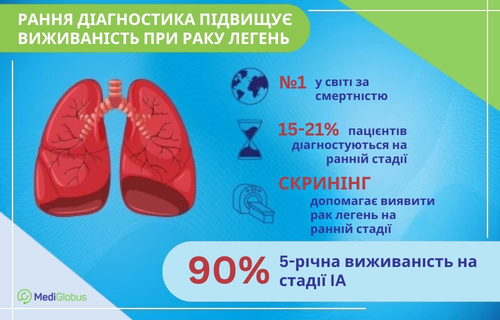 Інфографіка про рак легенів. Зліва зображено ілюстрацію легенів з вогнищами ураження, праворуч — статистику. У тексті йдеться про те, що рак легенів посідає перше місце у світі за смертністю, лише 15–21% випадків виявляються на ранній стадії, а скринінг сприяє своєчасній діагностиці, що підвищує 5-річну виживаність на стадії IA до 90%.