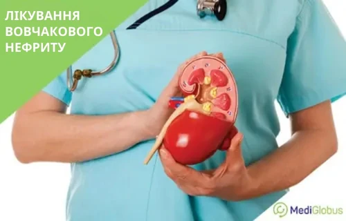 Lechenie-volchanochnogo-nefrita-uk Лікування вовчакового нефриту