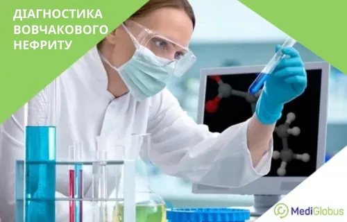 diagnoz-volchanochnui-nefrit-za-rubejom-uk діагностика люпус-нефриту
