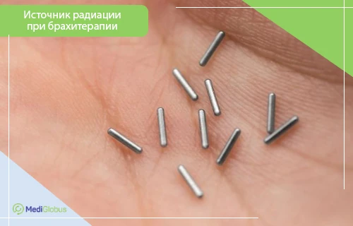 брахитерапия в гинекологии