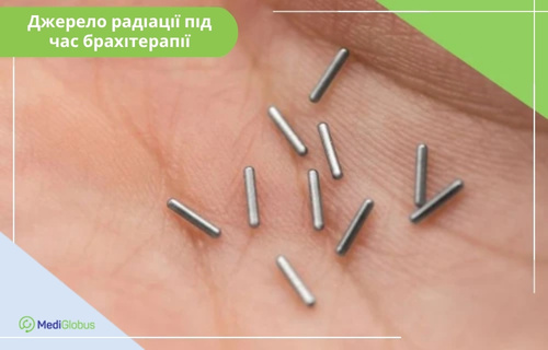 Крупний план: на долоні людини лежать кілька крихітних металевих радіоактивних капсул (сидів) у формі тонких циліндрів, які використовуються для брахітерапії під час лікування раку. Зліва вгорі розміщено напис «Джерело радіації під час брахітерапії».