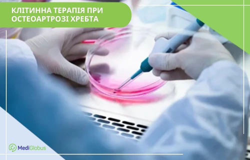 stem-cell-treatment-of-spinal-osteoarthritis-uk стовбурові клітини при остеоартрозі хребта