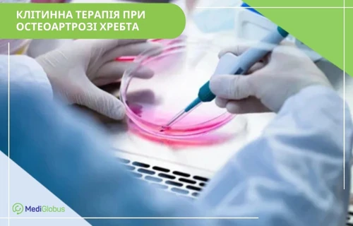 stem-cell-treatment-of-spinal-osteoarthritis-uk стовбурові клітини при остеоартрозі хребта