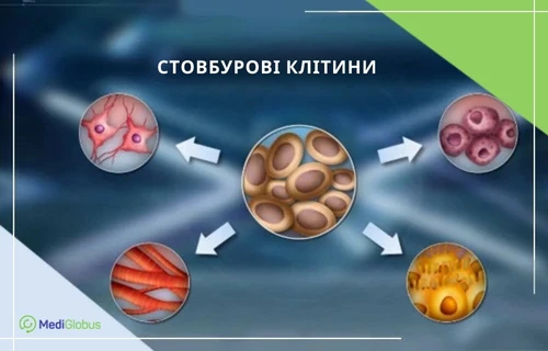 лікування стовбуровими клітинами