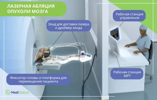 лазерное удаление опухоли головного мозга
