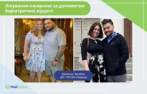 Treatment-of-obesity-with-bariatric-surgery-uk хірургія для лікування ожиріння