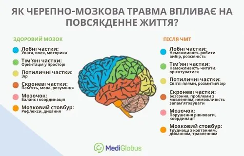 Пошкодження мозку при ЧМТ Інфографіка: Які функції мозку втрачаються після черепно-мозкової травми