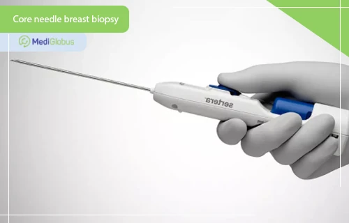 core biopsy of breast