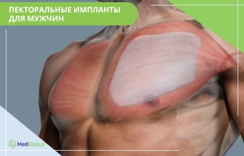 грудные импланты для мужчин