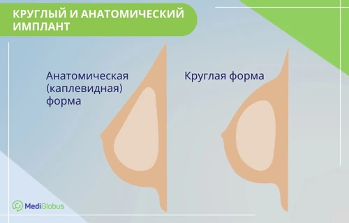 импланты грудные круглые или анатомические