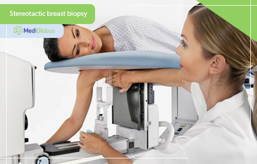 steretactic vacuum breast biopsy