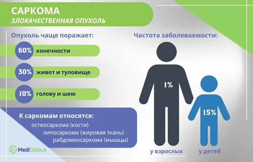 Что такое саркома