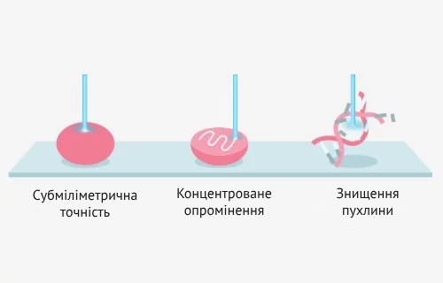 переваги протонної терапії