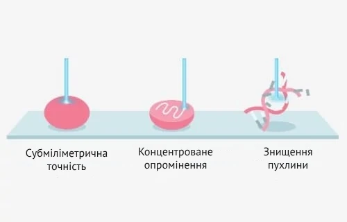 benefits_of_proton_therapy_ukr переваги протонної терапії