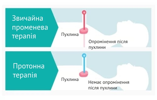 порівняння протонної терапії з радіотерапією
