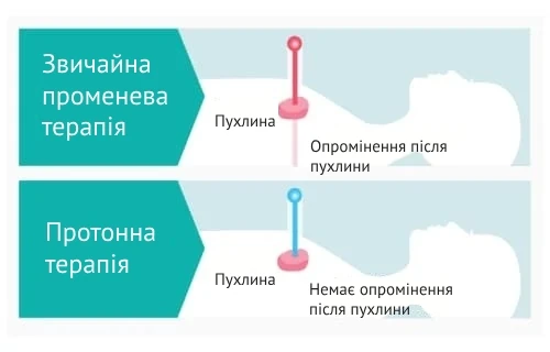 radiotherapy_proton_therapy_comp_ukr порівняння протонної терапії з радіотерапією