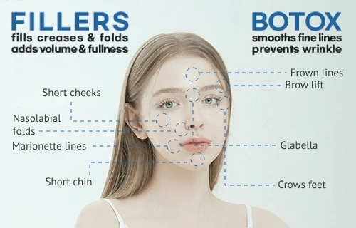 girin_botox_fillers_eng otox and fillers at girin hospital