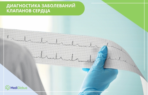 Руки врача в голубых перчатках держат бумажную ленту с результатами электрокардиограммы (ЭКГ). В верхнем углу плаката надпись: «Диагностика заболеваний клапанов сердца»