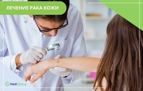 Врач в белом халате и перчатках через лупу осматривает небольшое пятно на руке пациентки. Текст сверху: «Лечение рака кожи».